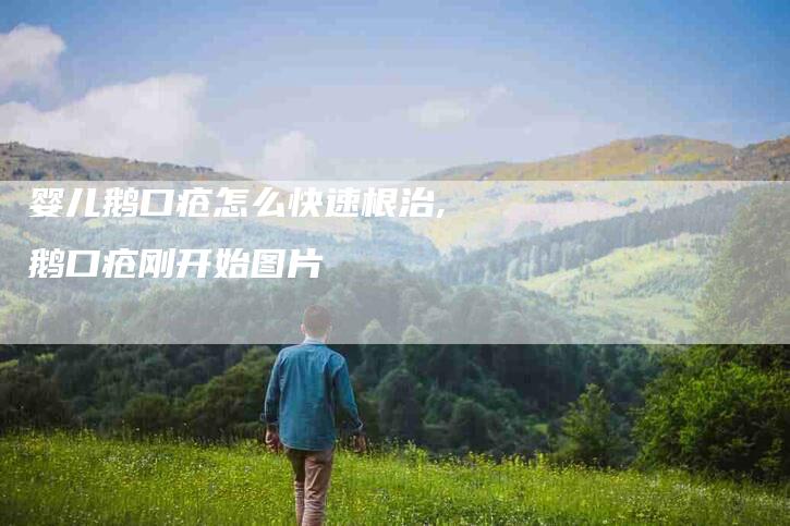 婴儿鹅口疮怎么快速根治,鹅口疮刚开始图片